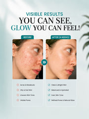 The Perfect Skincare Combo | Cleanse, Treat & Glow Set