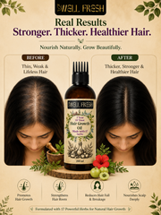 Hair Growth Oil | Made with 17 Powerful Herbs | 200 ml
