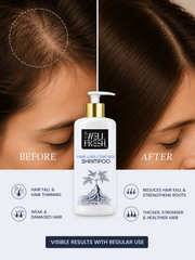 control hair loss shampoo