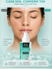 Niacinamide and Glycolic Acid Face Serum for Pimples Dark Spots and Pore Care