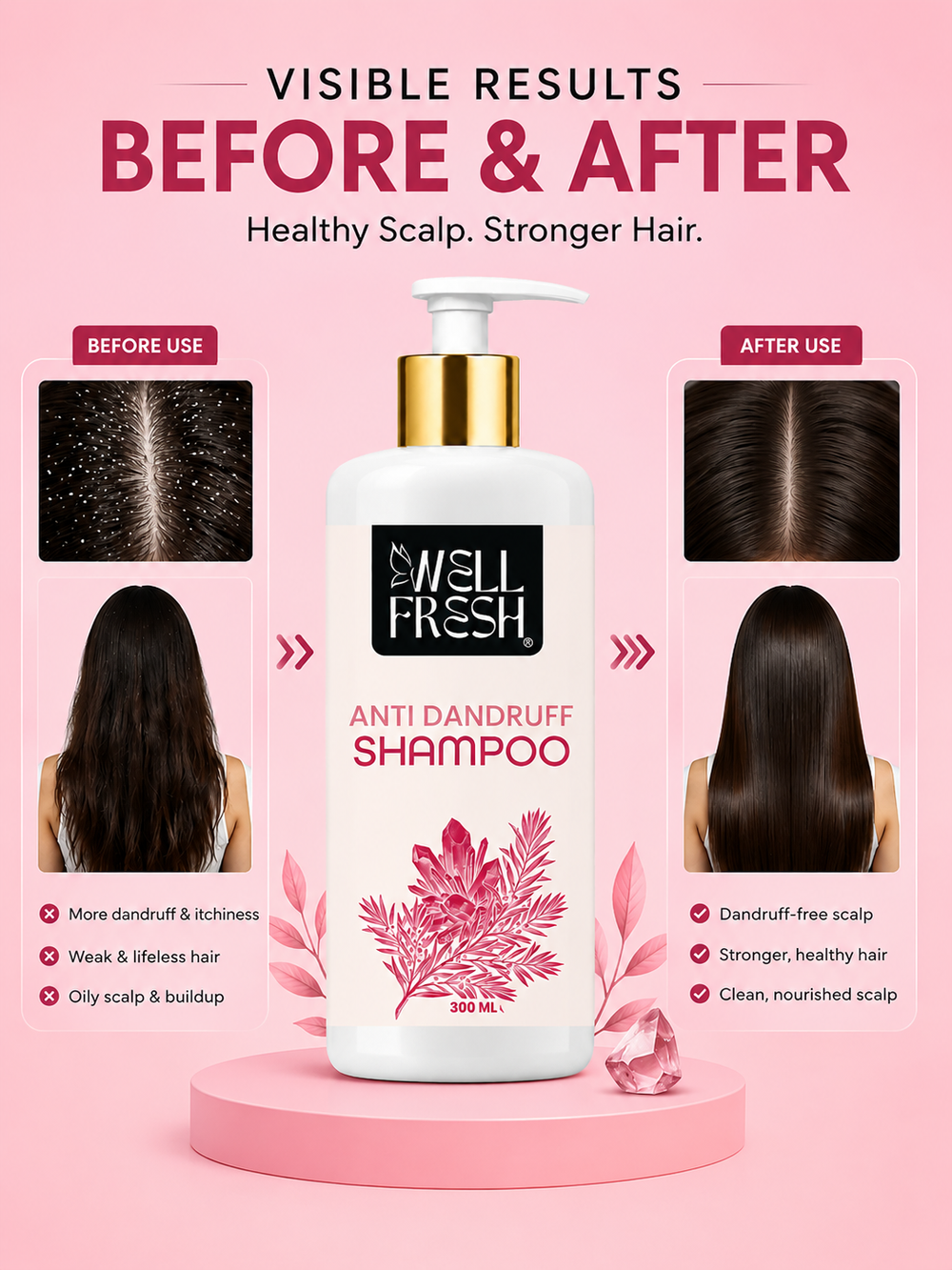 Anti Dandruff Shampoo for Soft Clean and Manageable Hair