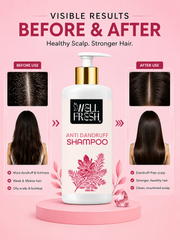 Anti Dandruff Shampoo for Soft Clean and Manageable Hair