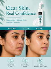 Niacinamide and Salicylic Acid Face Wash for Acne Prone and Oily Skin