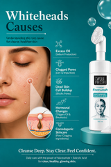 Niacinamide and Salicylic Acid Face Wash for Acne Prone and Oily Skin